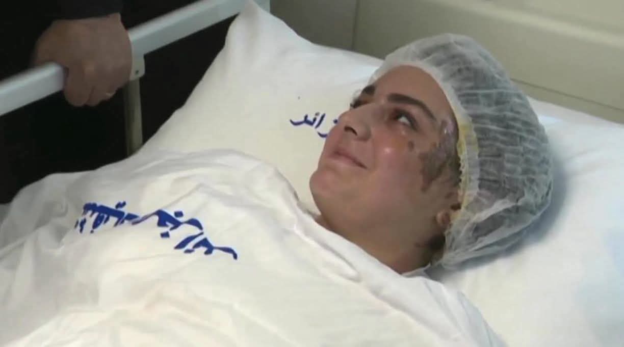 رئيس الجمهورية يطمئن الأطفال المصابين: الدولة ستتكفل بكم بما في ذلك الجراحات التجميلية
